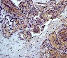 Immunohistochemistry (Formalin/PFA-fixed paraffin-embedded sections) - Anti-STAT2 antibody [Y141] - BSA and Azide free (AB239811)