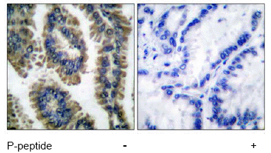 Immunohistochemistry (Formalin/PFA-fixed paraffin-embedded sections) - Anti-STAT2 (phospho Y690) antibody (AB53132)
