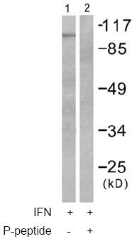 Western blot - Anti-STAT2 (phospho Y690) antibody (AB53132)