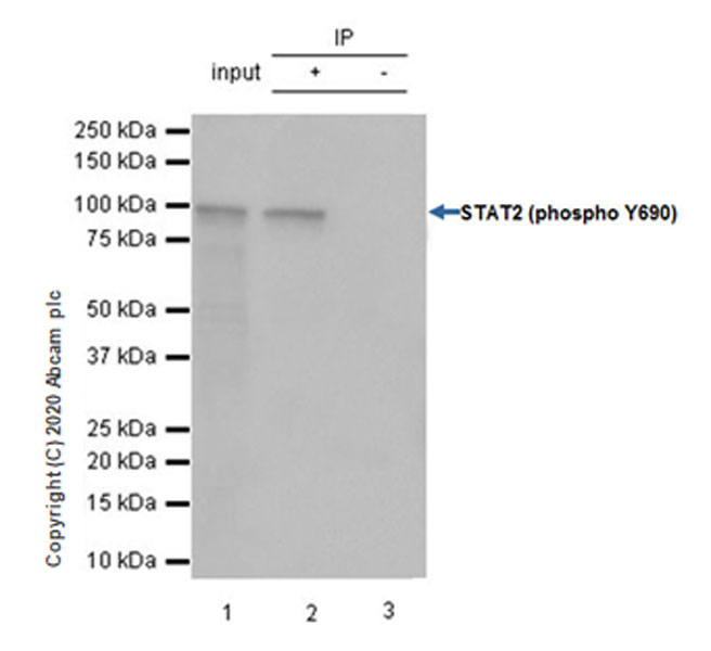 Immunoprecipitation - Anti-STAT2 (phospho Y690) antibody [EPR18549-42] - ChIP Grade (AB191601)