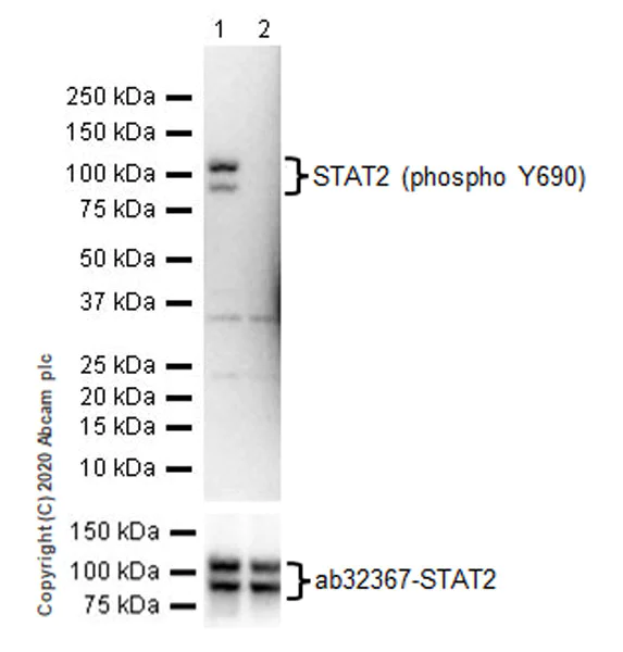 Western blot - Anti-STAT2 (phospho Y690) antibody [EPR18549-42] - ChIP Grade - BSA and Azide free (AB277618)