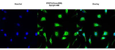 Immunocytochemistry/ Immunofluorescence - Anti-STAT3 antibody [9D8] (AB119352), expandable thumbnail