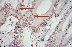 Immunohistochemistry (Formalin/PFA-fixed paraffin-embedded sections) - Anti-STAT3 antibody [9D8] (ab119352), expandable thumbnail