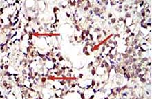 Immunohistochemistry (Formalin/PFA-fixed paraffin-embedded sections) - Anti-STAT3 antibody [9D8] (ab119352), expandable thumbnail