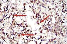Immunohistochemistry (Formalin/PFA-fixed paraffin-embedded sections) - Anti-STAT3 antibody [9D8] (AB119352)