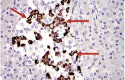 Immunohistochemistry (Formalin/PFA-fixed paraffin-embedded sections) - Anti-STAT3 antibody [9D8] (AB119352)