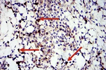 Immunohistochemistry (Formalin/PFA-fixed paraffin-embedded sections) - Anti-STAT3 antibody [9D8] (AB119352)