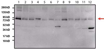 Western blot - Anti-STAT3 antibody [9D8] (AB119352), expandable thumbnail