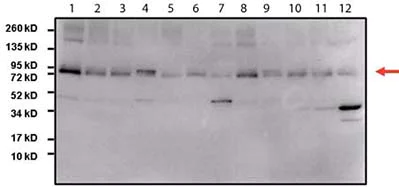Western blot - Anti-STAT3 antibody [9D8] (AB119352)