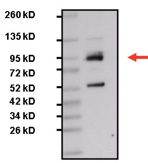 Western blot - Anti-STAT3 antibody [9D8] (ab119352), expandable thumbnail