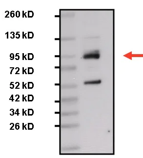 Western blot - Anti-STAT3 antibody [9D8] (AB119352)