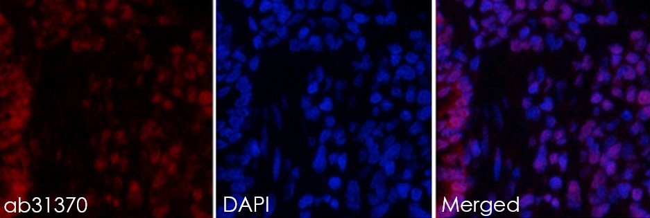 Immunohistochemistry (Formalin/PFA-fixed paraffin-embedded sections) - Anti-STAT3 antibody (AB31370), expandable thumbnail