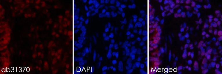 Immunohistochemistry (Formalin/PFA-fixed paraffin-embedded sections) - Anti-STAT3 antibody (AB31370)