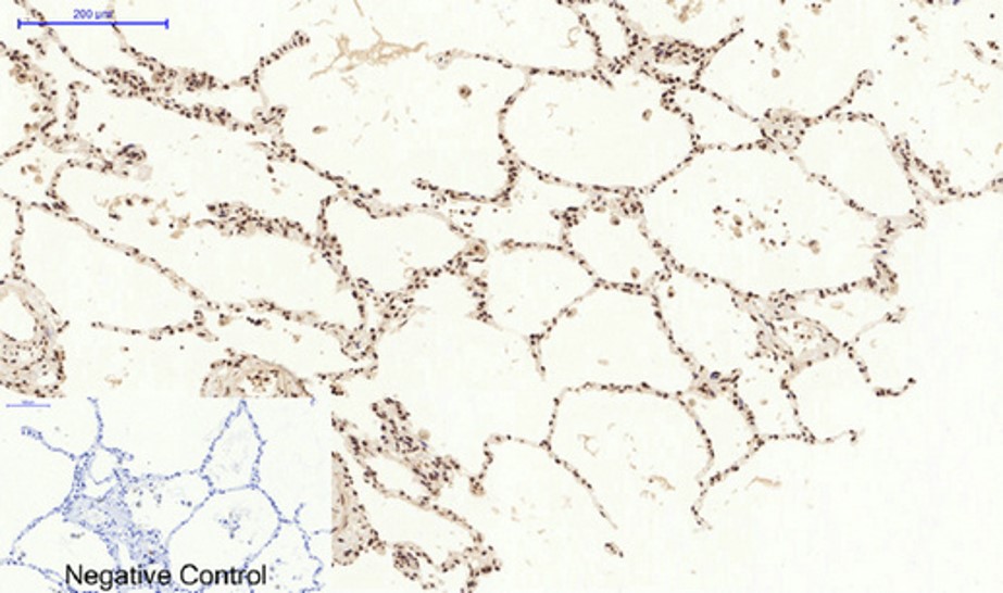 Immunohistochemistry (Formalin/PFA-fixed paraffin-embedded sections) - Anti-STAT3 antibody (AB31370), expandable thumbnail