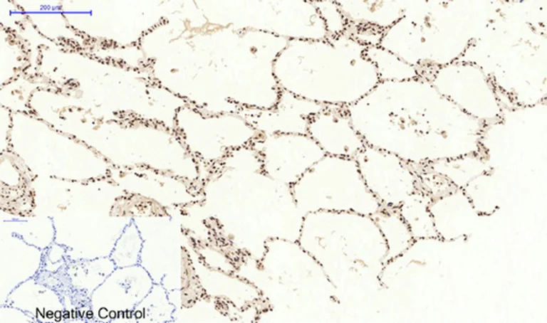 Immunohistochemistry (Formalin/PFA-fixed paraffin-embedded sections) - Anti-STAT3 antibody (AB31370)