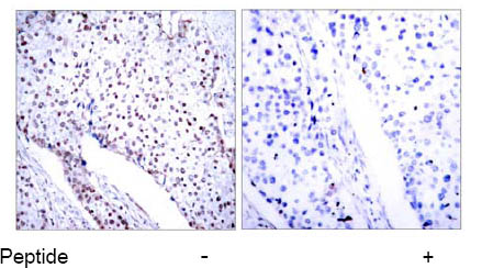 Immunohistochemistry (Formalin/PFA-fixed paraffin-embedded sections) - Anti-STAT3 antibody (AB31370), expandable thumbnail