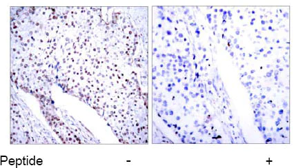 Immunohistochemistry (Formalin/PFA-fixed paraffin-embedded sections) - Anti-STAT3 antibody (AB31370)