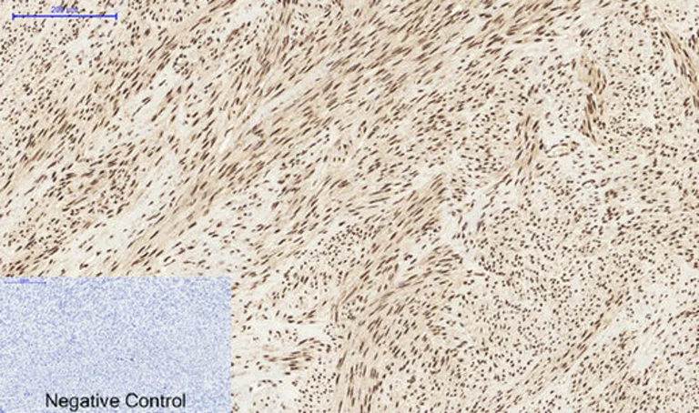 Immunohistochemistry (Formalin/PFA-fixed paraffin-embedded sections) - Anti-STAT3 antibody (AB31370)