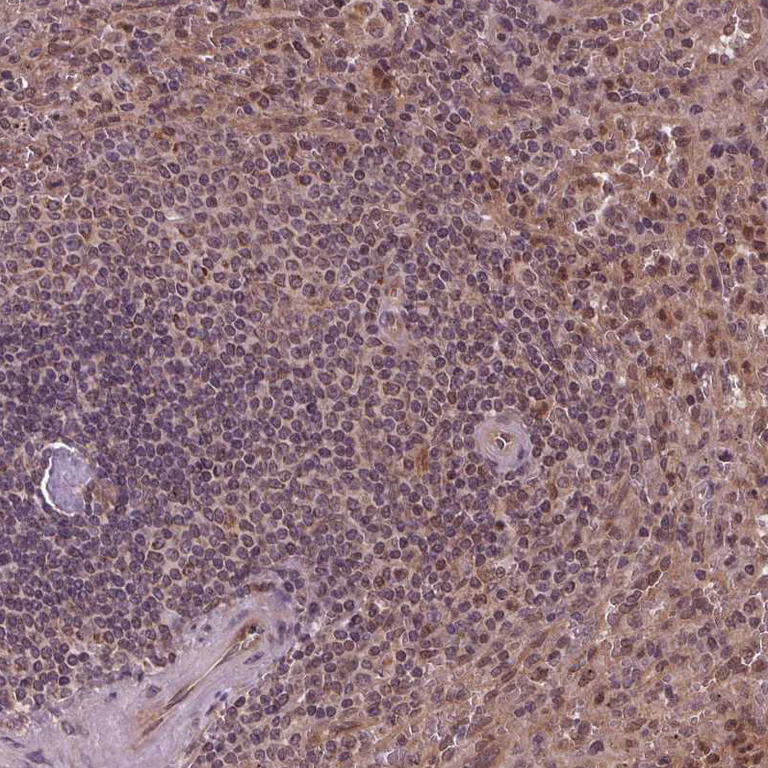 Immunohistochemistry (Formalin/PFA-fixed paraffin-embedded sections) - Anti-STAT3 Antibody (AB327249)
