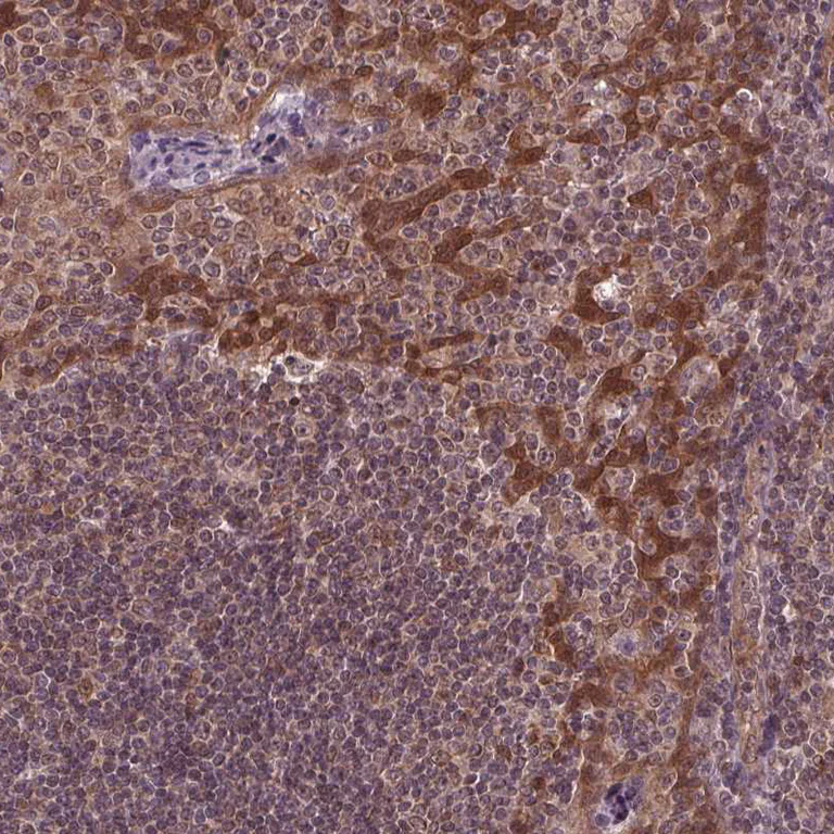 Immunohistochemistry (Formalin/PFA-fixed paraffin-embedded sections) - Anti-STAT3 Antibody (AB327249)