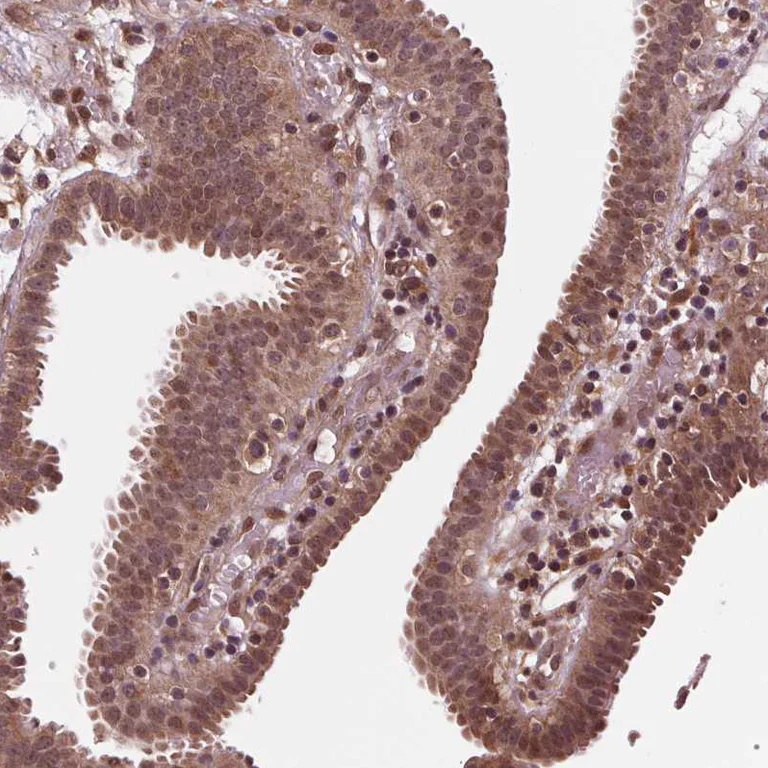 Immunohistochemistry (Formalin/PFA-fixed paraffin-embedded sections) - Anti-STAT3 Antibody (AB327249)