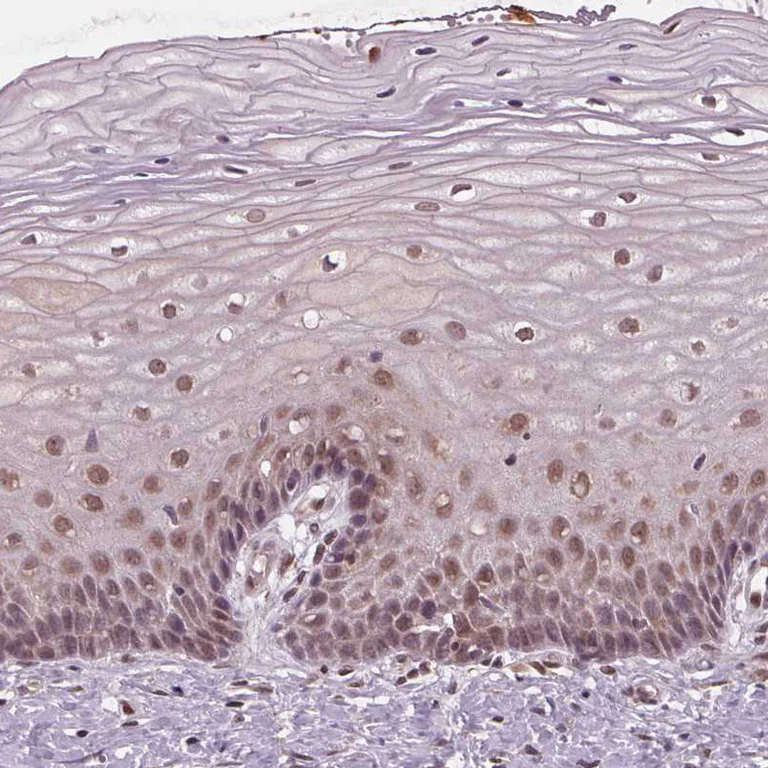 Immunohistochemistry (Formalin/PFA-fixed paraffin-embedded sections) - Anti-STAT3 Antibody (AB327249)