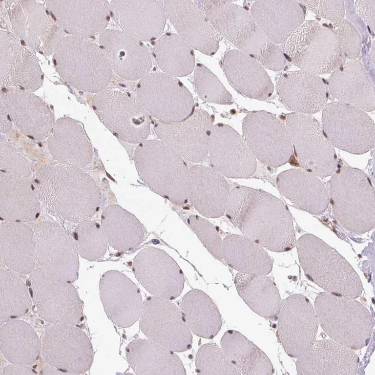 Immunohistochemistry (Formalin/PFA-fixed paraffin-embedded sections) - Anti-STAT3 Antibody (AB327249)