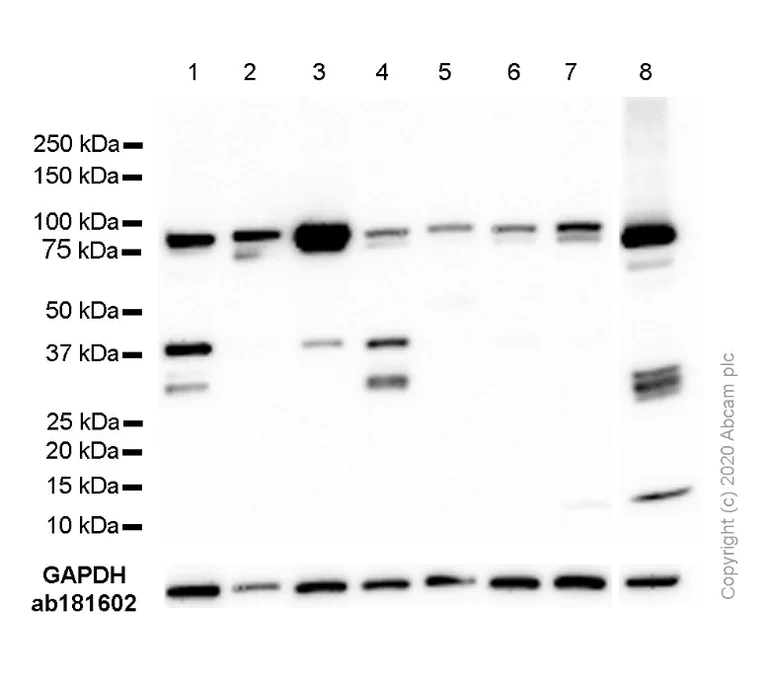 Western blot - Anti-STAT3 antibody [EPR361] (AB109085)
