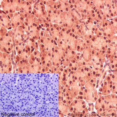 Immunohistochemistry (Formalin/PFA-fixed paraffin-embedded sections) - Anti-STAT3 antibody [EPR361] - BSA and Azide free (AB171360)