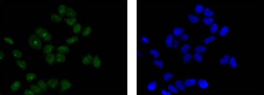 Immunocytochemistry/ Immunofluorescence - Anti-STAT3 antibody [EPR787Y] (AB68153), expandable thumbnail