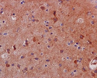 Immunohistochemistry (Formalin/PFA-fixed paraffin-embedded sections) - Anti-STAT3 antibody [EPR787Y] (ab68153), expandable thumbnail