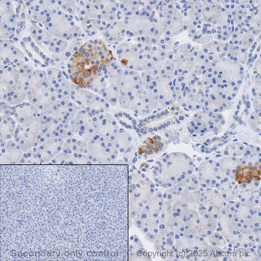 Immunohistochemistry (Formalin/PFA-fixed paraffin-embedded sections) - Anti-STAT3 antibody [EPR787Y] (ab68153), expandable thumbnail