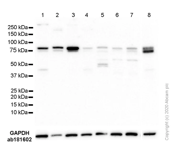 Western blot - Anti-STAT3 antibody [EPR787Y] (AB68153)