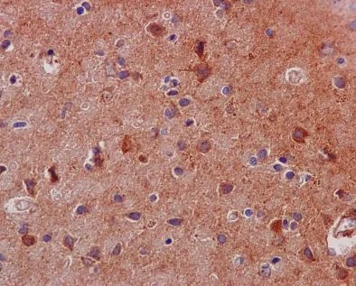 Immunohistochemistry (Formalin/PFA-fixed paraffin-embedded sections) - Anti-STAT3 antibody [EPR787Y] - BSA and Azide free (AB171359)