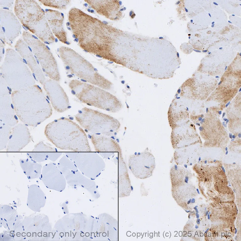 Immunohistochemistry (Formalin/PFA-fixed paraffin-embedded sections) - Anti-STAT3 antibody [EPR787Y] - BSA and Azide free (AB171359)
