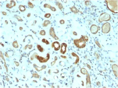 Immunohistochemistry (Formalin/PFA-fixed paraffin-embedded sections) - Anti-STAT3 antibody [STAT3/2409] - BSA and Azide free (AB237909)