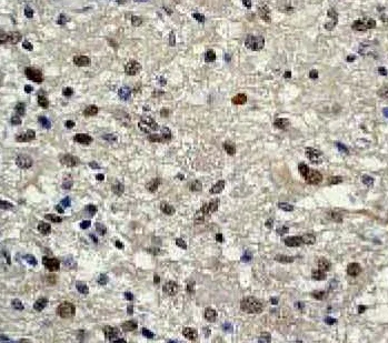 Immunohistochemistry (Formalin/PFA-fixed paraffin-embedded sections) - Anti-STAT3 (phospho S727) antibody [E121-31] (AB32143)
