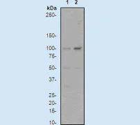 Western blot - Anti-STAT3 (phospho S727) antibody [E121-31] (AB32143)