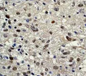 Immunohistochemistry (Formalin/PFA-fixed paraffin-embedded sections) - Anti-STAT3 (phospho S727) antibody [E121-31] - BSA and Azide free (AB219593)