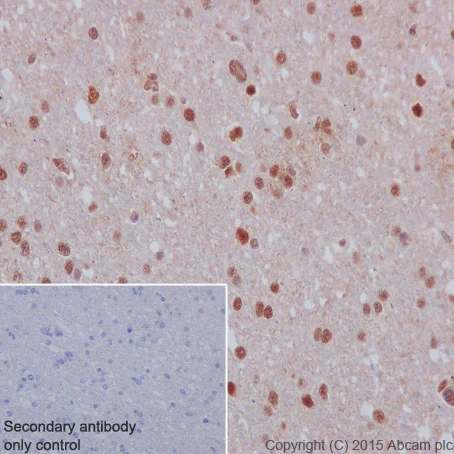 Immunohistochemistry (Formalin/PFA-fixed paraffin-embedded sections) - Anti-STAT3 (phospho S727) antibody [E121-31] - BSA and Azide free (AB219593)