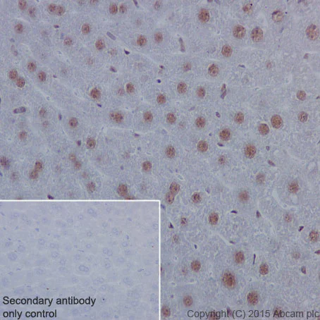 Immunohistochemistry (Formalin/PFA-fixed paraffin-embedded sections) - Anti-STAT3 (phospho S727) antibody [E121-31] - BSA and Azide free (AB219593)