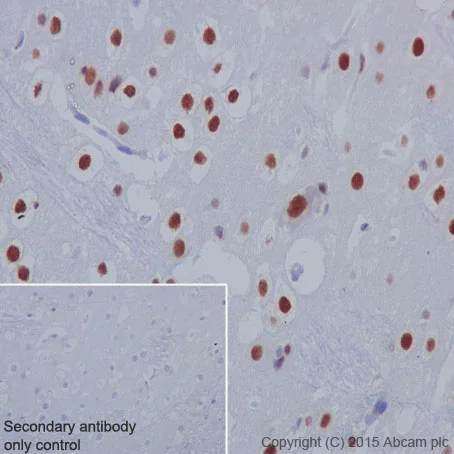 Immunohistochemistry (Formalin/PFA-fixed paraffin-embedded sections) - Anti-STAT3 (phospho S727) antibody [E121-31] - BSA and Azide free (AB219593)
