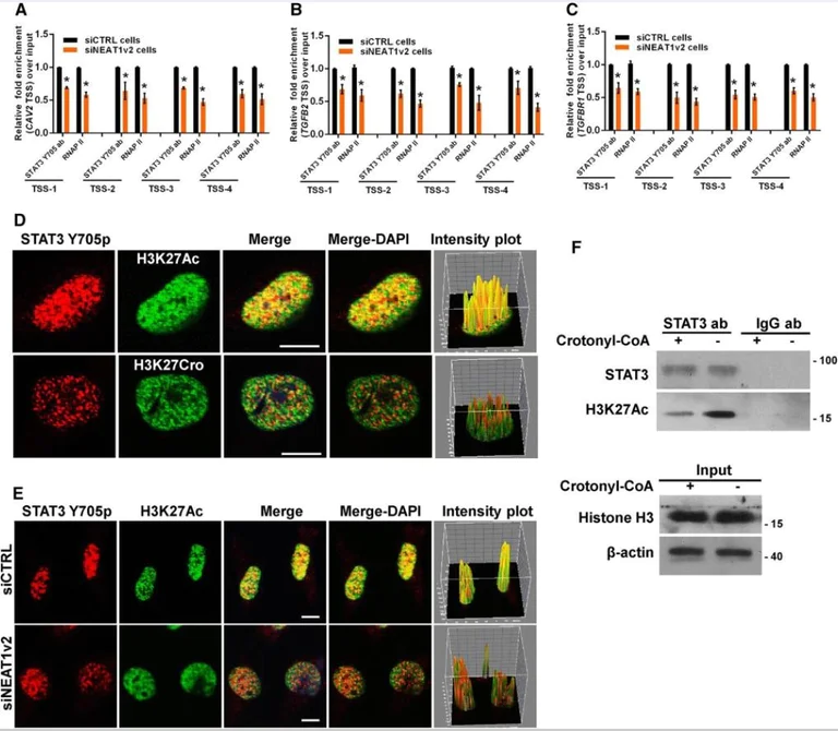 Immunocytochemistry/ Immunofluorescence - Anti-STAT3 (phospho Y705) antibody [EP2147Y] (AB76315)
