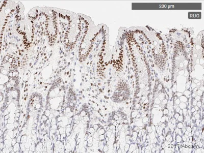 Immunohistochemistry (Formalin/PFA-fixed paraffin-embedded sections) - Anti-STAT3 (phospho Y705) antibody [EP2147Y] (AB76315)