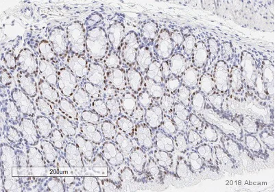 Immunohistochemistry (Formalin/PFA-fixed paraffin-embedded sections) - Anti-STAT3 (phospho Y705) antibody [EP2147Y] (AB76315)