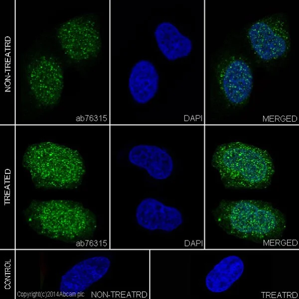 Immunocytochemistry/ Immunofluorescence - Anti-STAT3 (phospho Y705) antibody [EP2147Y] - BSA and Azide free (AB171358)