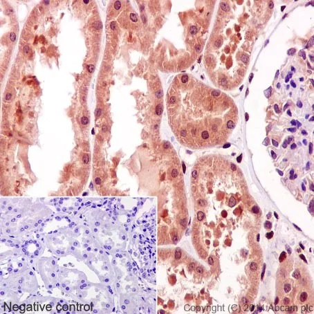 Immunohistochemistry (Formalin/PFA-fixed paraffin-embedded sections) - Anti-STAT3 (phospho Y705) antibody [EP2147Y] - BSA and Azide free (AB171358)