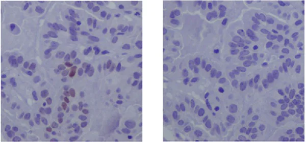 Immunohistochemistry (Formalin/PFA-fixed paraffin-embedded sections) - Anti-STAT3 (phospho Y705) antibody [EP2147Y] - BSA and Azide free (AB171358)