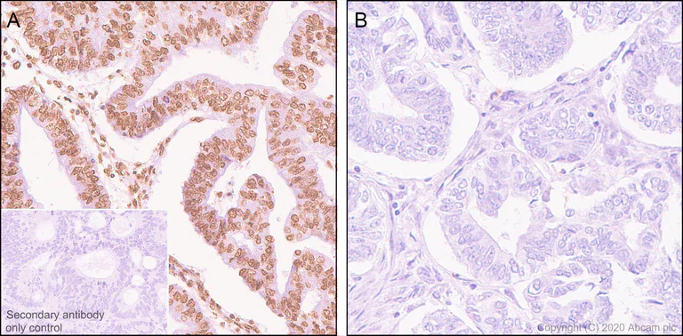 Immunohistochemistry (Formalin/PFA-fixed paraffin-embedded sections) - Anti-STAT3 (phospho Y705) antibody [EPR23968-52] (AB267373)