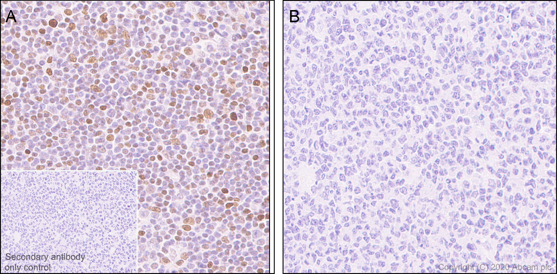 Immunohistochemistry (Formalin/PFA-fixed paraffin-embedded sections) - Anti-STAT3 (phospho Y705) antibody [EPR23968-52] (ab267373), expandable thumbnail